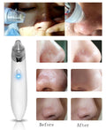 Ange Aile Comedo Blackhead Vacuum Suction Diamond Removal Wrink  Acne Pore Peeling Face Clean Facial Skin Care Beauty Machine